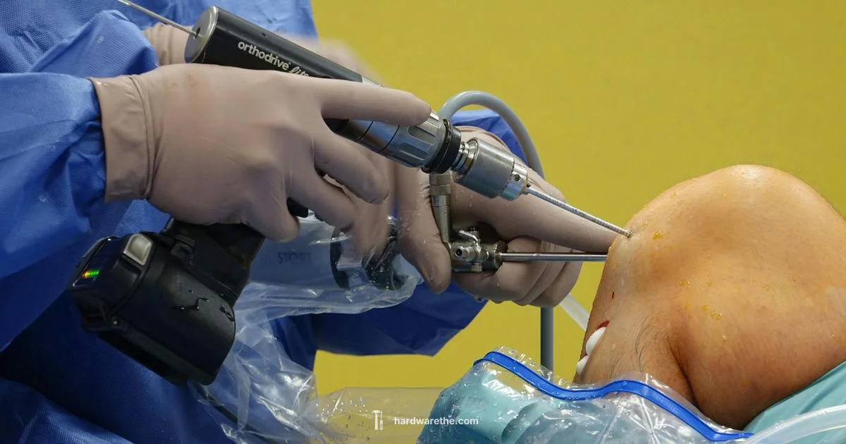 Bone Remodeling After Removal Bone Remodeling After Removal - The Hardware